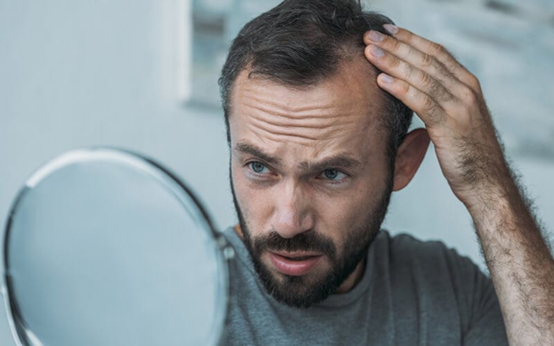 A man checking a bald spot in a mirror with a dour look on his face.